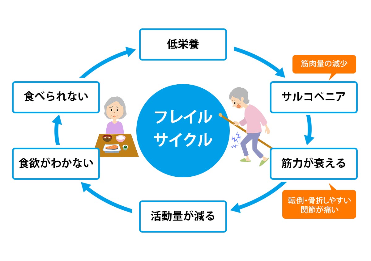 サルコペニアと口腔機能低下症|セントラル歯科クリニック|静岡市駿河区新川のなるべく削らない歯科医院 | 静岡市駿河区の歯医者|セントラル歯科クリニック